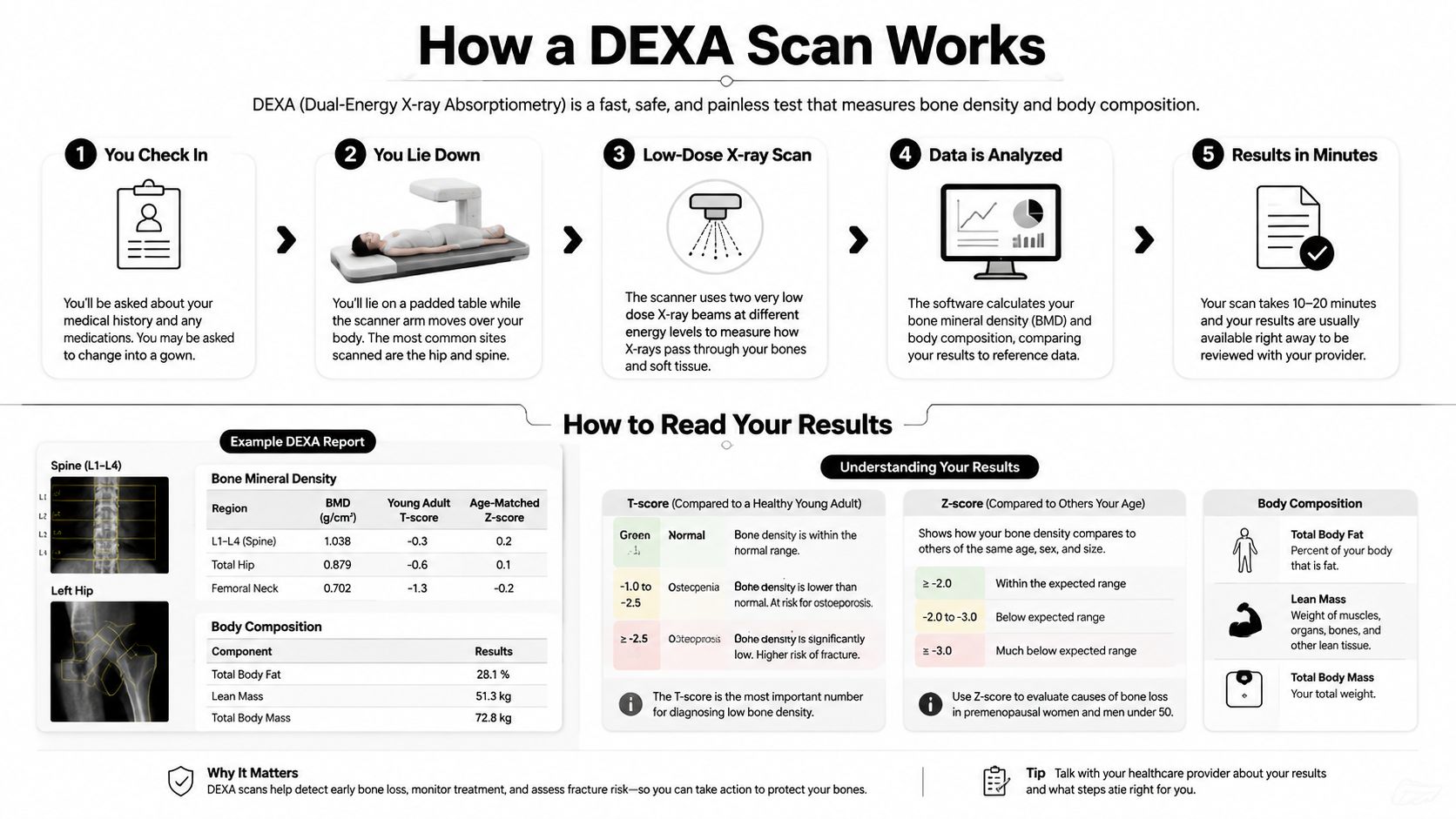 An infographic explaining the DEXA scan process, how to read results, and understanding bone density test metrics.