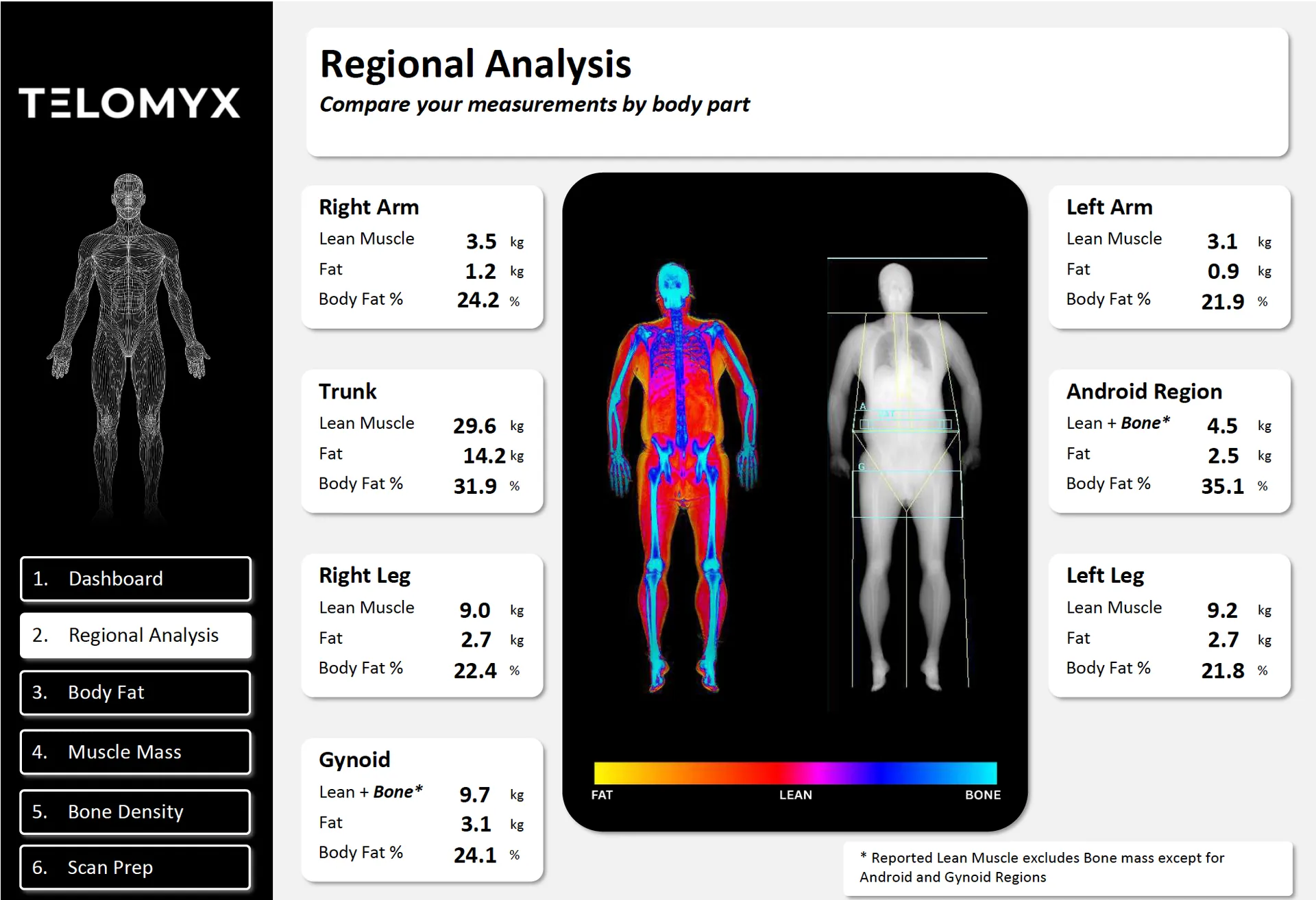Example of the regional analysis of a DEXA Body composition scan