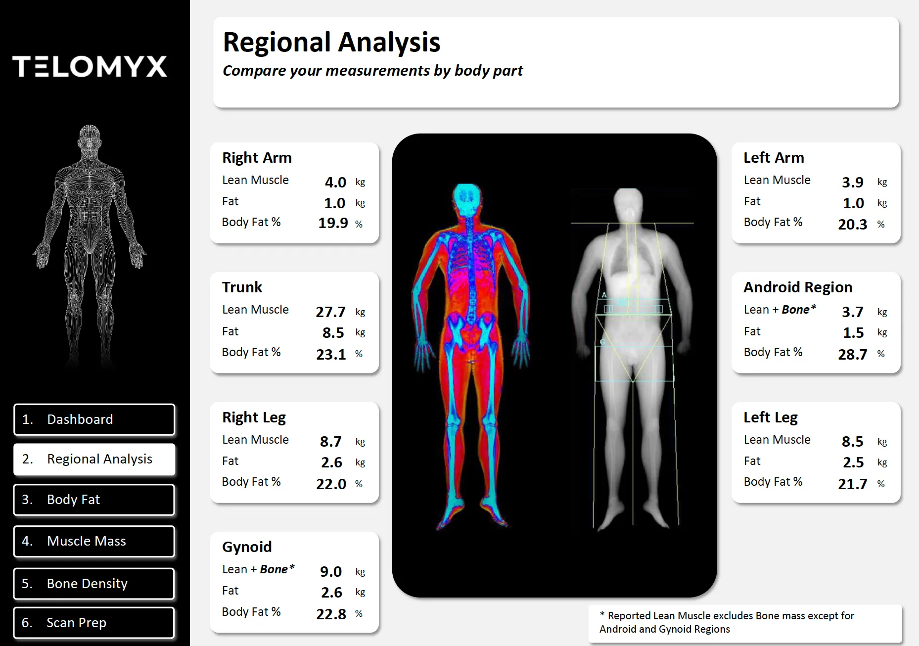 The regional analysis section of the Telomyx DEXA report