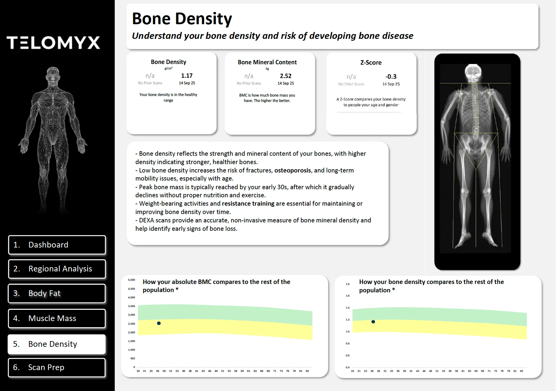 The bone density section of the Telomyx DEXA report
